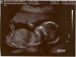 Abigail's Ultrasound Pictures